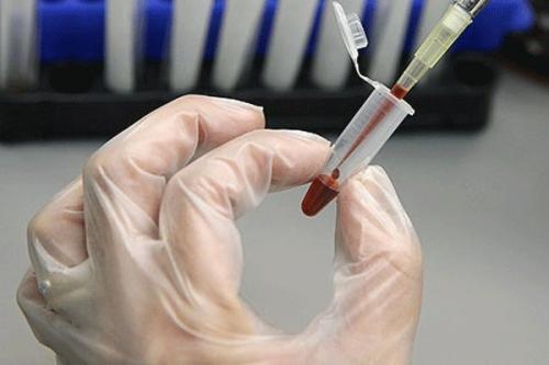  خون بند ناف موثر در درمان 80بیماری لاعلاج