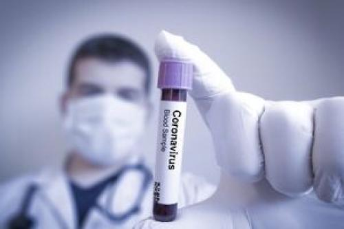 تولیدداروی ضد ویروس درمان کرونا  