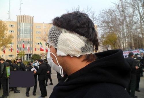دستگیری عامل گوش بری در تهران 