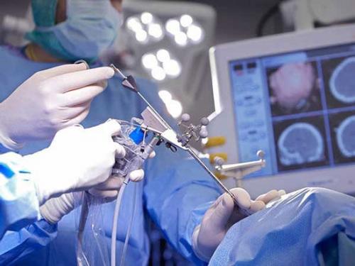 اولین عمل جراحی مغز به شیوه نورو اندوسکوپی در کرمانشاه انجام شد