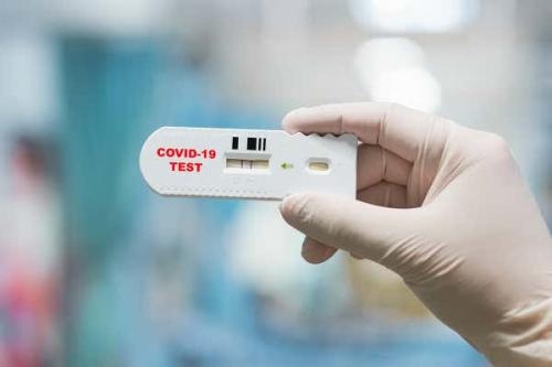  آزمایش فوری و کم‌هزینه برای تشخیص کروناویروس