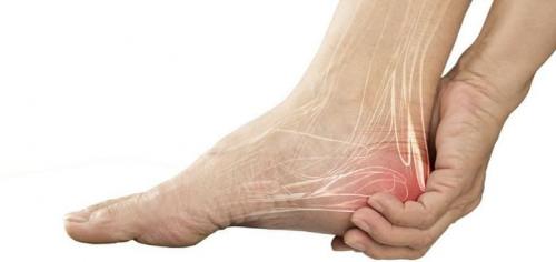 دلایل درد در ناحیه پاشنه چپ پا و راه‌های درمان