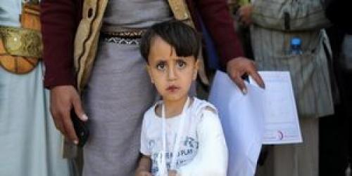  از آغاز حمله ائتلاف سعودی به یمن روزانه ۴ کودک کشته یا مجروح می‌شوند