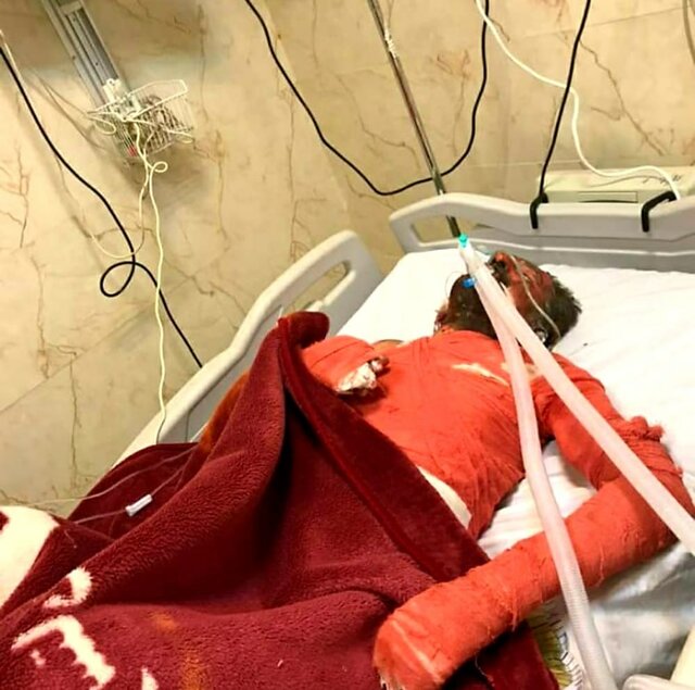 فرزند شهید یاسوجی که خودسوزی کرده بود درگذشت