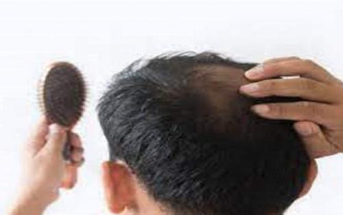علت ریزش مو در فصل پاییز چیست؟