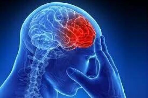 علائم اصلی سکته مغزی ناقص چیست؟