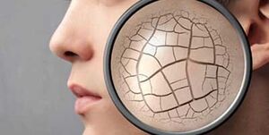 ۵ نشانه پوستی را جدی بگیرید ۵ نشانه پوستی را جدی بگیرید