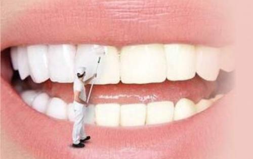 علت اصلی تغییر رنگ دندان‌ها