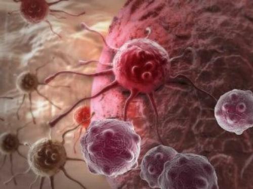  پروستات شایعترین تومور خوش خیم در مردان