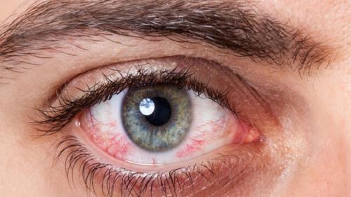 عواقب خطرناک عفونت چشمی 