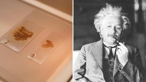  ماجرای عجیب دزدی مغز اینشتین توسط یک پزشک