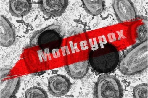  "آبله میمونی" وضعیت اضطراری بهداشت جهانی اعلام شد