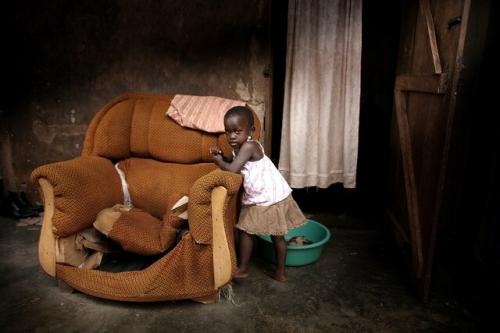  سوء تغذیه و بیماری جان کودکان زیادی را در شاخ آفریقا به خطر انداخته است