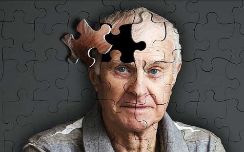 ۱۲ روش برای جلوگیری از ابتلا به آلزایمر
