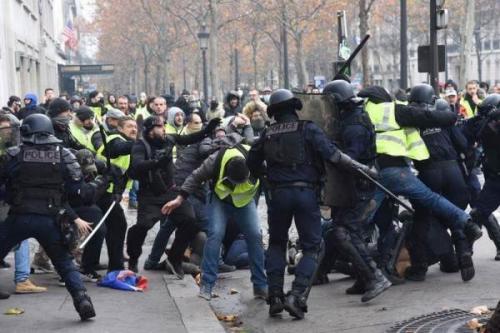 قطع‌شدن دست یک فرد در اعتراضات فرانسه
