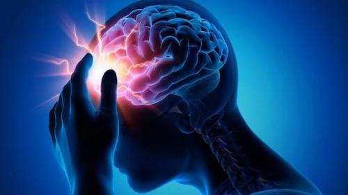  عوامل موثر در بروز سکته مغزی کدامند؟