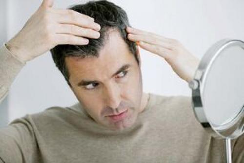  دلیل اصلی ریزش موی مردان و زنان