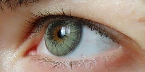  خطراتی که لنزهای چشمی را تهدید می‌کنند+فیلم 