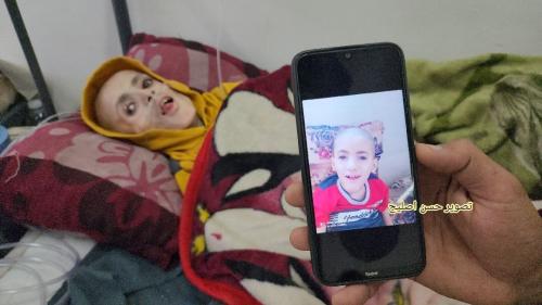 شهادت کودکی در غزه بر اثر سوء تغذیه