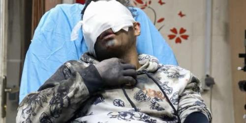 آمار مصدومین و قربانیان چهارشنبه سوری امسال