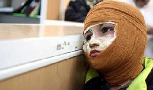 چراغ نفتی بازهم در سیستان حادثه آفرید 