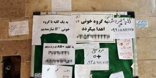  دلالی خرید و فروش کلیه در بازار جگرسوز!