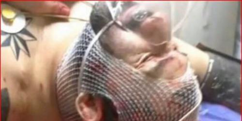 گنده لات تهران ازمرگ فرارکرد /«هانی کرده» در یک قدمی مرگ