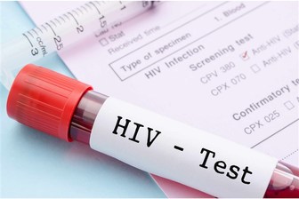افزایش خطرانسدادمزمن ریوی در مبتلایان بهHIV