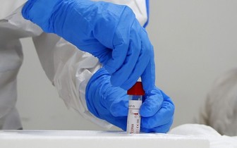  پاسخ ساده به یک سوال درباره بیولوژیک بودن کرونا 