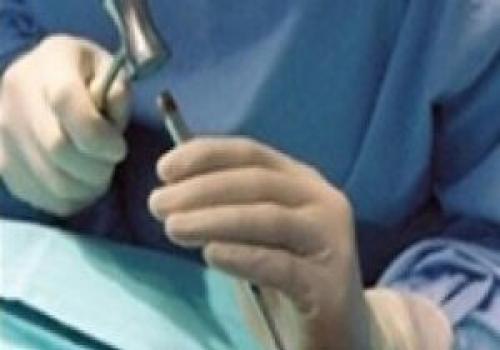 عمل زیبایی جان دختر جوان را گرفت!