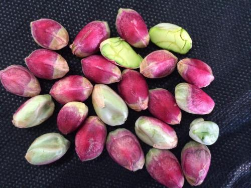 معجزه‌ی پسته تازه برای سلامتی 