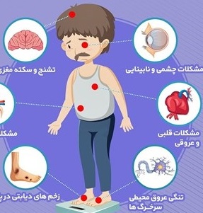 اینفوگرافیک/ دیابت را بشناسیم! اینفوگرافیک/ دیابت را بشناسیم!