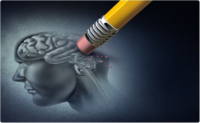آلزایمر خطرناک اما قابل کنترل