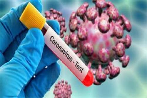 بهترین زمان تست PCR در افراد علامت دار کرونا