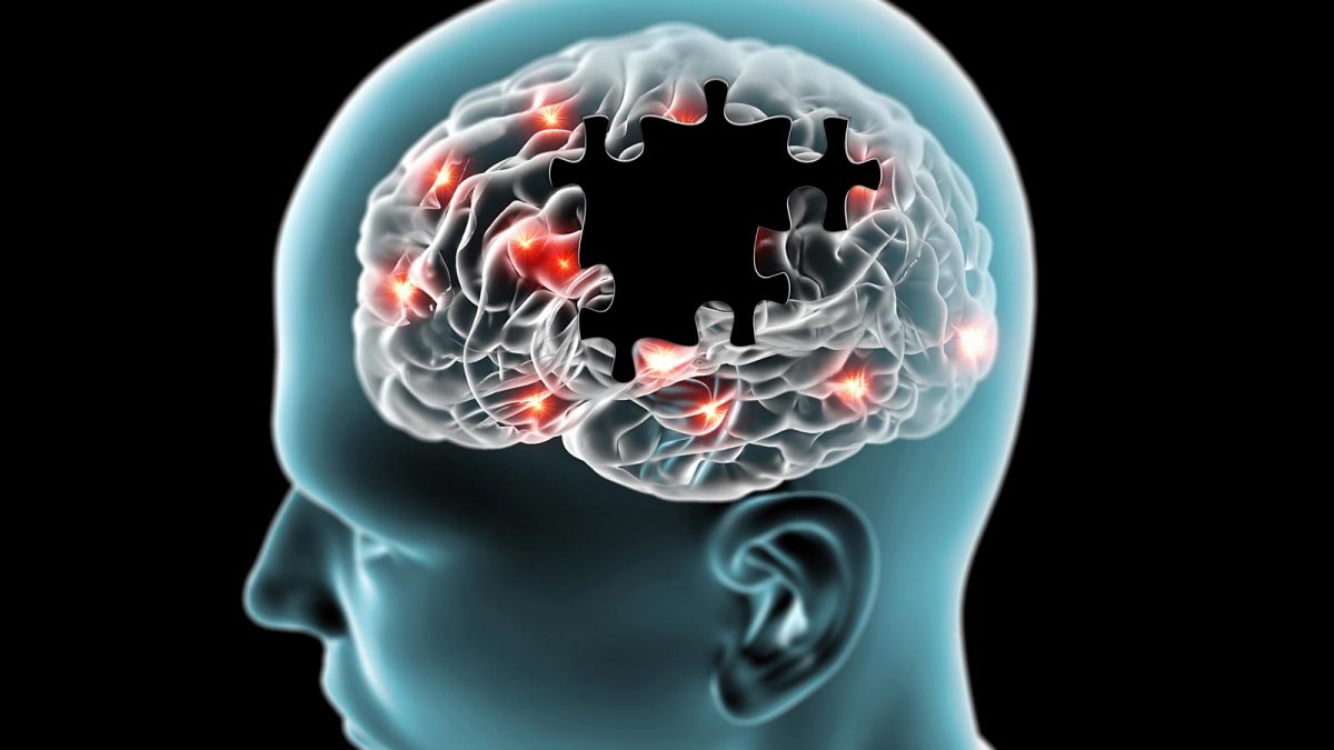 دارویی جدید برای توقف بیماری آلزایمر
