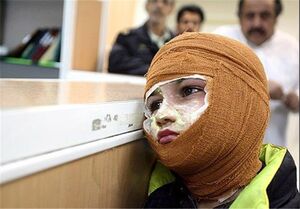 افزایش آمار مصدومان «چهارشنبه سوزی» افزایش آمار مصدومان «چهارشنبه سوزی»
