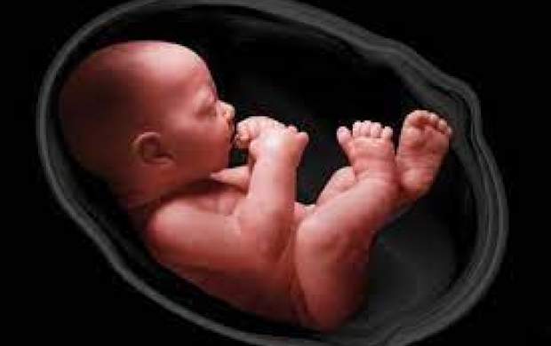 تغییر جنسیت جنین چند؟ +فیلم