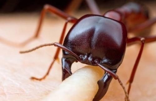 لحظه گاز گرفتن مورچه از انسان +تصاویر
