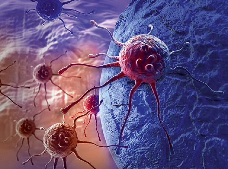  تشخیص ۵۰ نوع سرطان با یک آزمایش خون