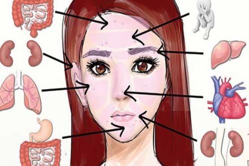 محل جوش‌ها بیماریتان را فاش می کنند 