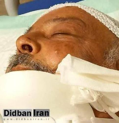  وزیر اسبق بهداشت دچار حادثه شد