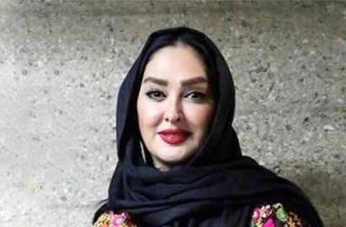 عکس الهام حمیدی که شباهت زیادی به چهره قبلی اش دارد 