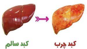 اینفوگرافیک / چند راه ساده برای بهبود عملکرد کبد