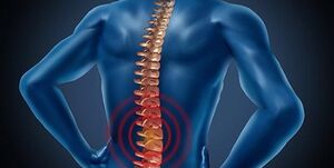 برای جلوگیری از درد دیسک کمر چه کاری انجام بدهیم؟