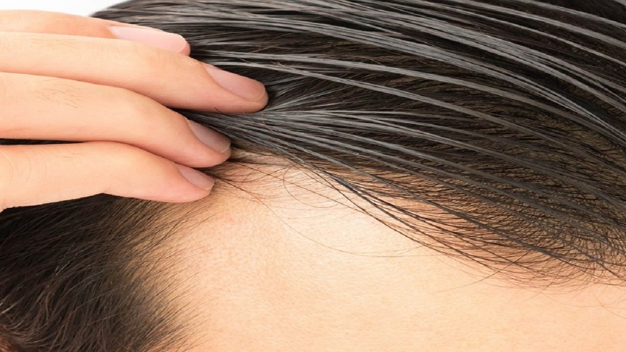 علت چرب شدن موی سر چیست؟