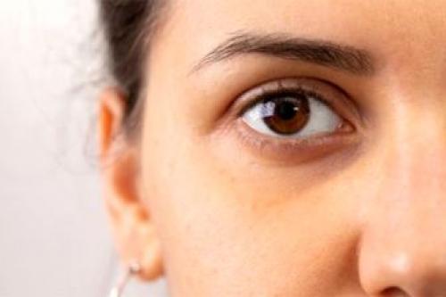  برای رفع گودی چشم چه کارهایی انجام دهیم 
