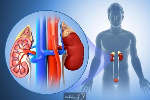  با این سه روش از کلیه‌های خود مراقبت کنید