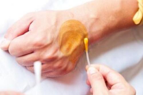  چرا نباید روی زخم بتادین ریخت؟
