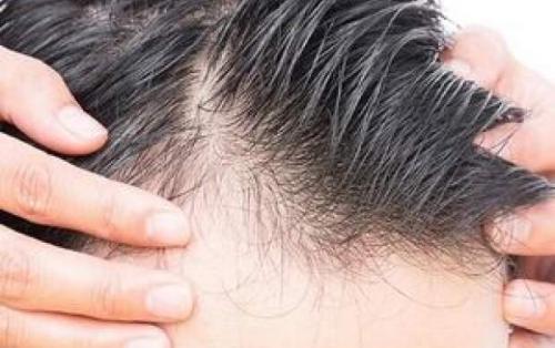 ترفندهای ساده برای رشد مو