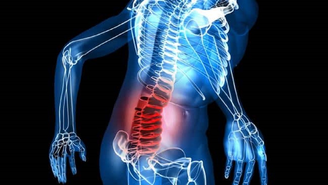  آرتروز در کدام مفاصل  بدن ایجاد می‌شود